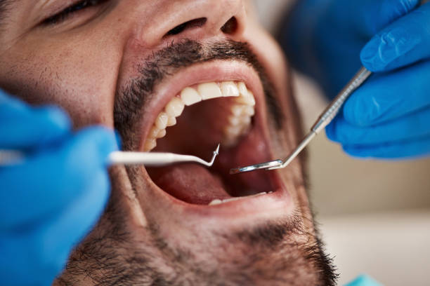 Best Pediatric Emergency Dentist in Allen Park, MI
